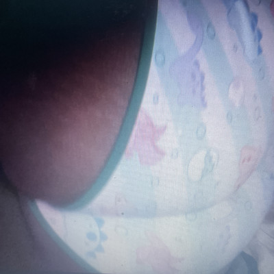 Onesie nap
